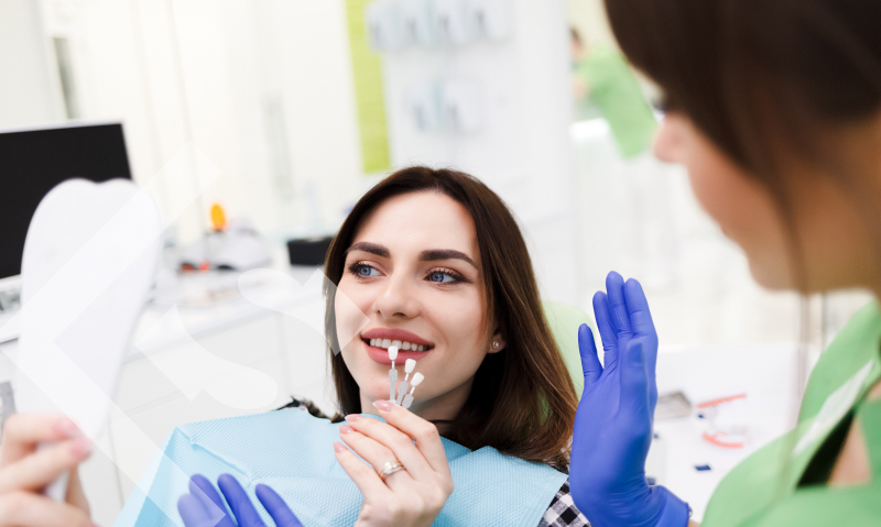 dental bonding and veneers