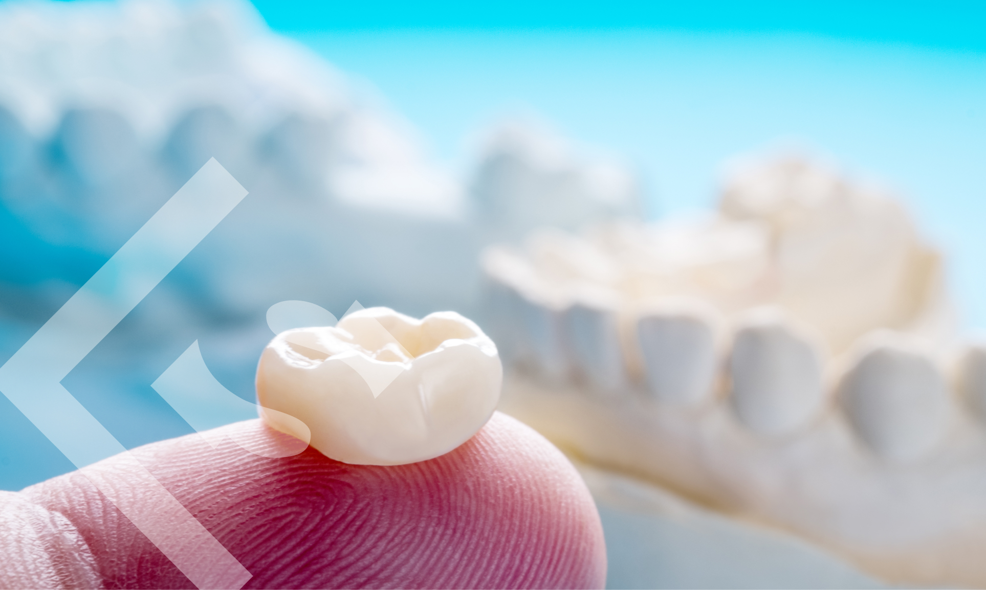All About Dental Crowns: 5 Ways They Restore and Enhance Your Smile