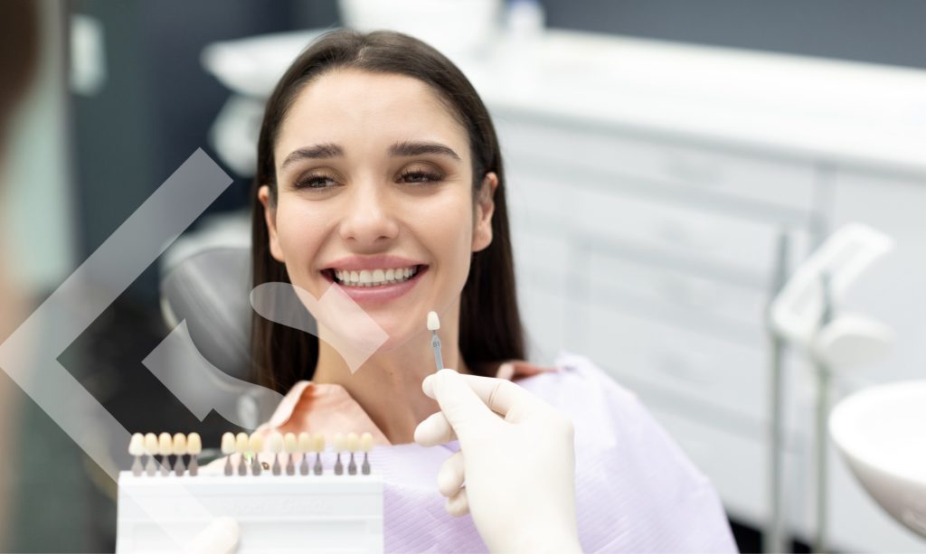 veneers right for you