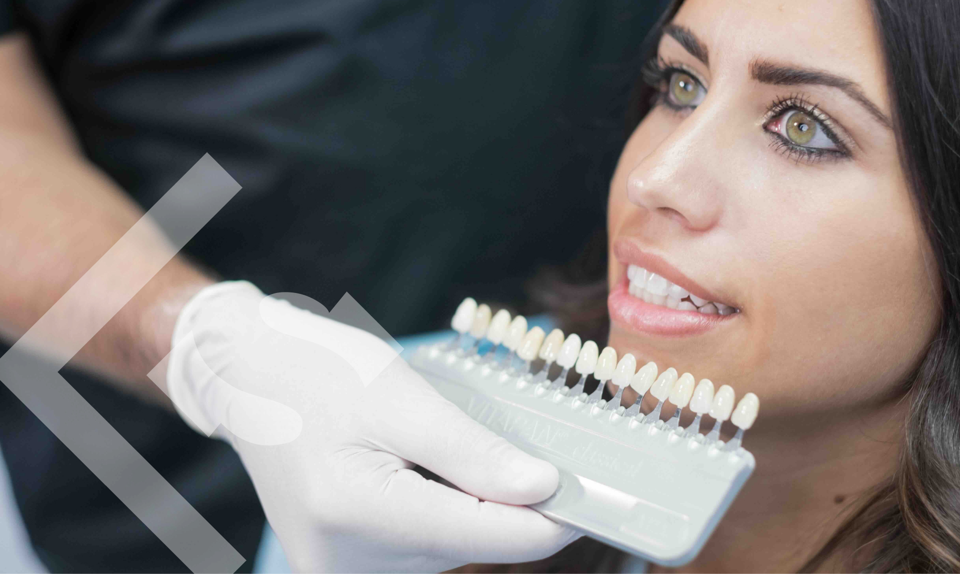 Safety Check: Exploring Dental Veneers for Your Smile