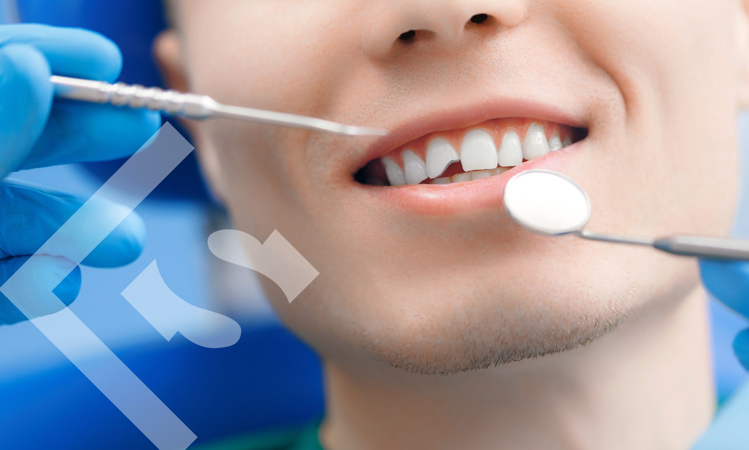 Quick Fix, Big Impact: How Dental Bonding Can Perfect Your Smile!