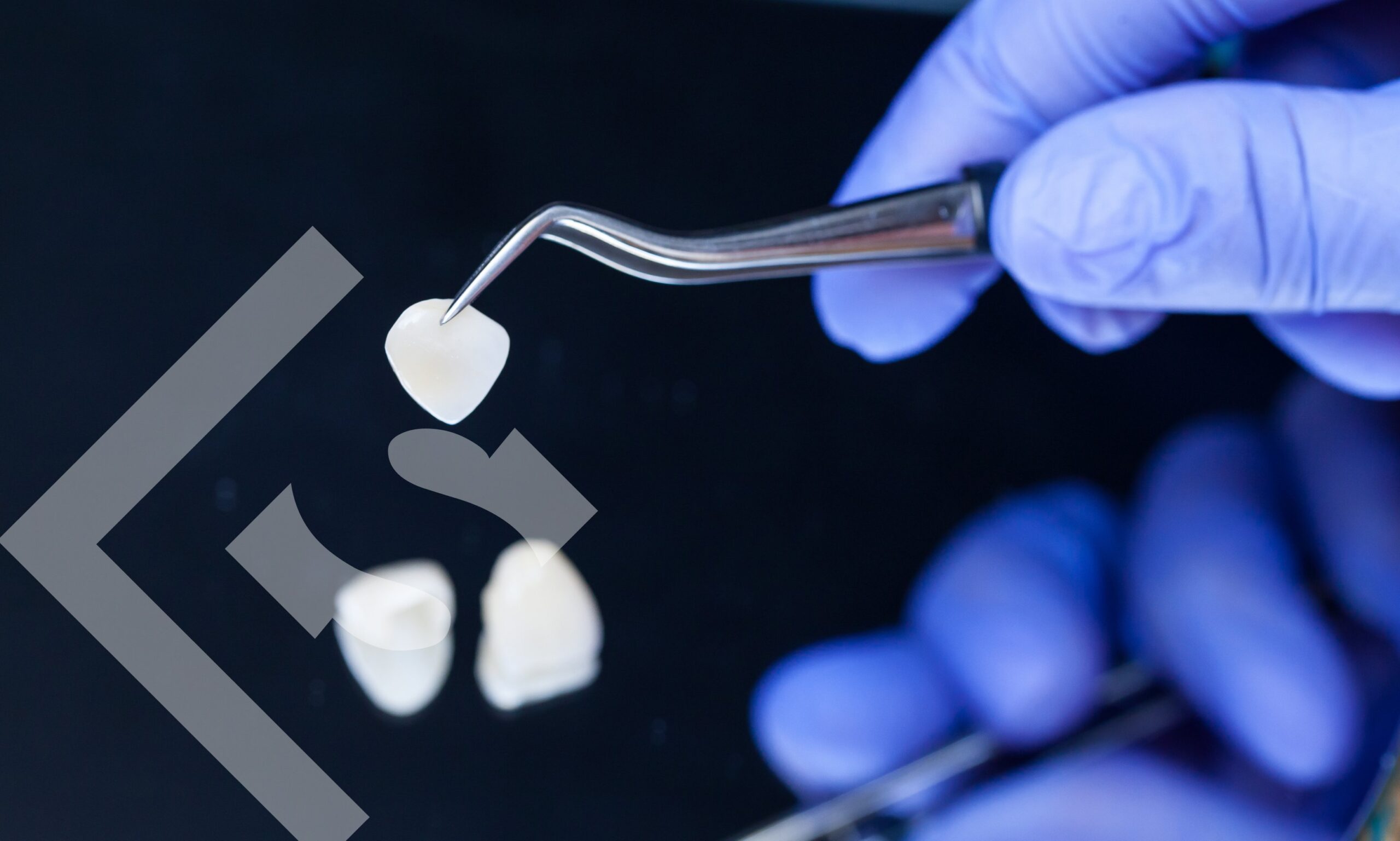 Veneers Can Do More Than Just Restore Your Smile