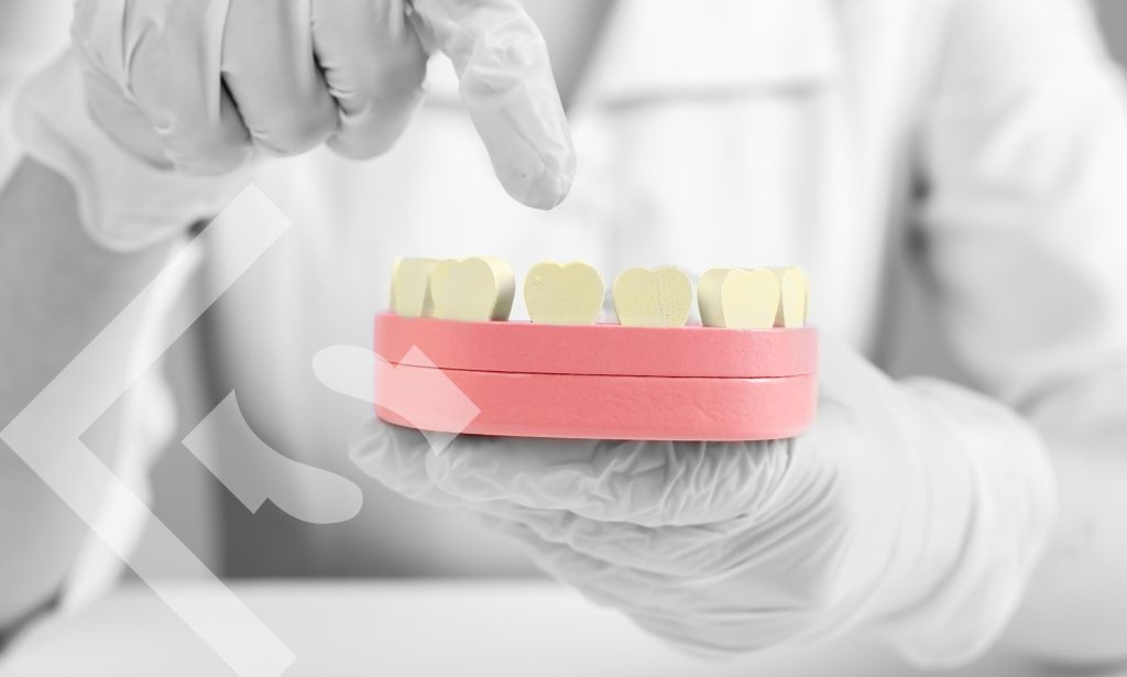 5 things yellow teeth