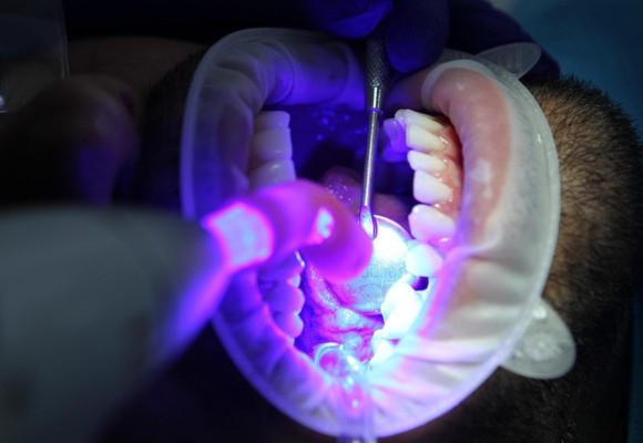 lum smiles cleaning & whitening