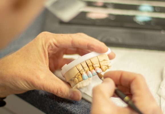 lum smiles composite artistry