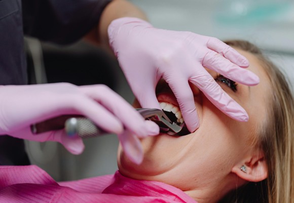 lum smiles extractions & bone grafting