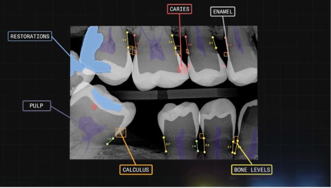 videahealth ai x ray analysis in luminous smiles