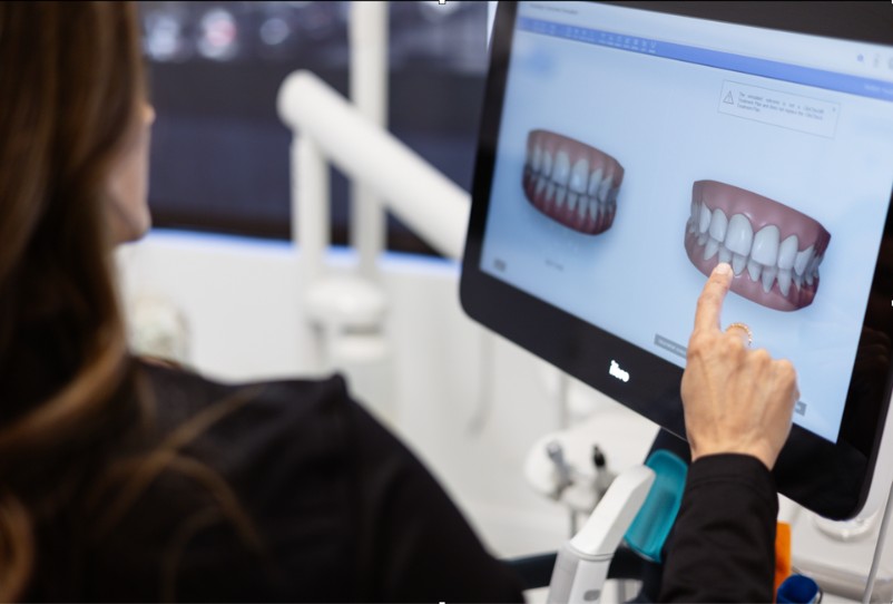 itero intraoral scanner in luminous smiles